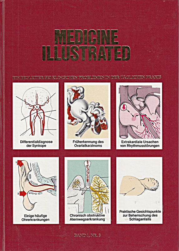 Medicine Illustrated Band 1 Nr. 3 Differentialdiagnose der Synkope Früherkennun