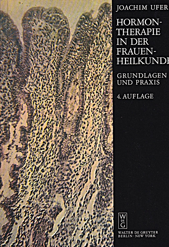 Joachim Ufer : Hormontherapie in der Frauenheilkunde - Grundlagen und Praxis