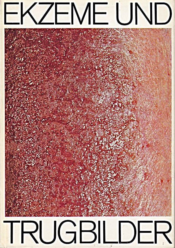 Ekzeme und Trugbilder