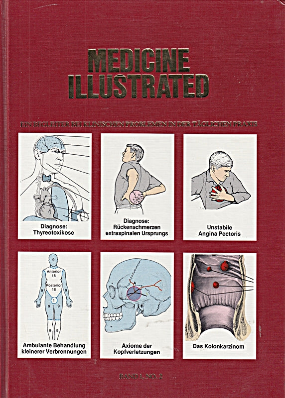 Medicine Illustrated. Ein Begleiter bei klinischen Problemen in der täglichen Praxis. Band I  No. 2. Ärztliche Fortbildung in Bild und Text. Diagnose: Thyreotoxikose; Diagnose: Rückenschmerzen extrasi