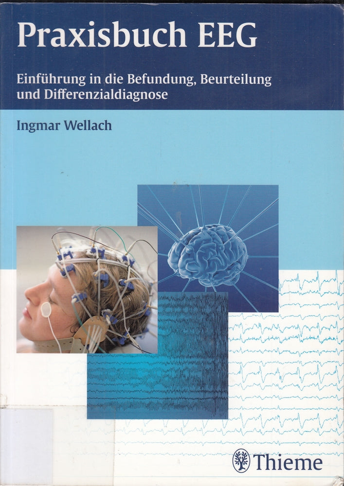 Praxisbuch EEG: Einführung in die Befundung  Beurteilung und Differenzialdiagnose