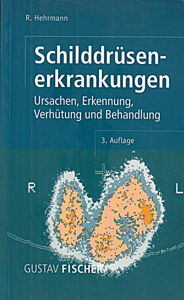 (Fischer  Gustav): Gustav Fischer Taschenbücher  Schilddrüsenerkrankungen